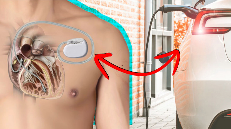 Kalp Pili Olanlar İçin Elektrikli Araç Kullanımı Güvenli mi?