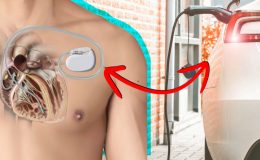Kalp Pili Olanlar İçin Elektrikli Araç Kullanımı Güvenli mi?