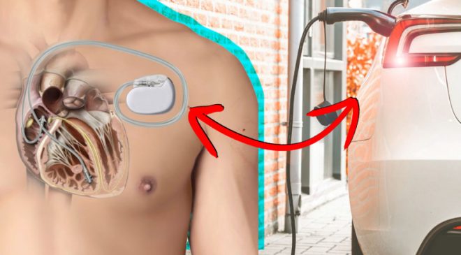 Kalp Pili Olanlar İçin Elektrikli Araç Kullanımı Güvenli mi?